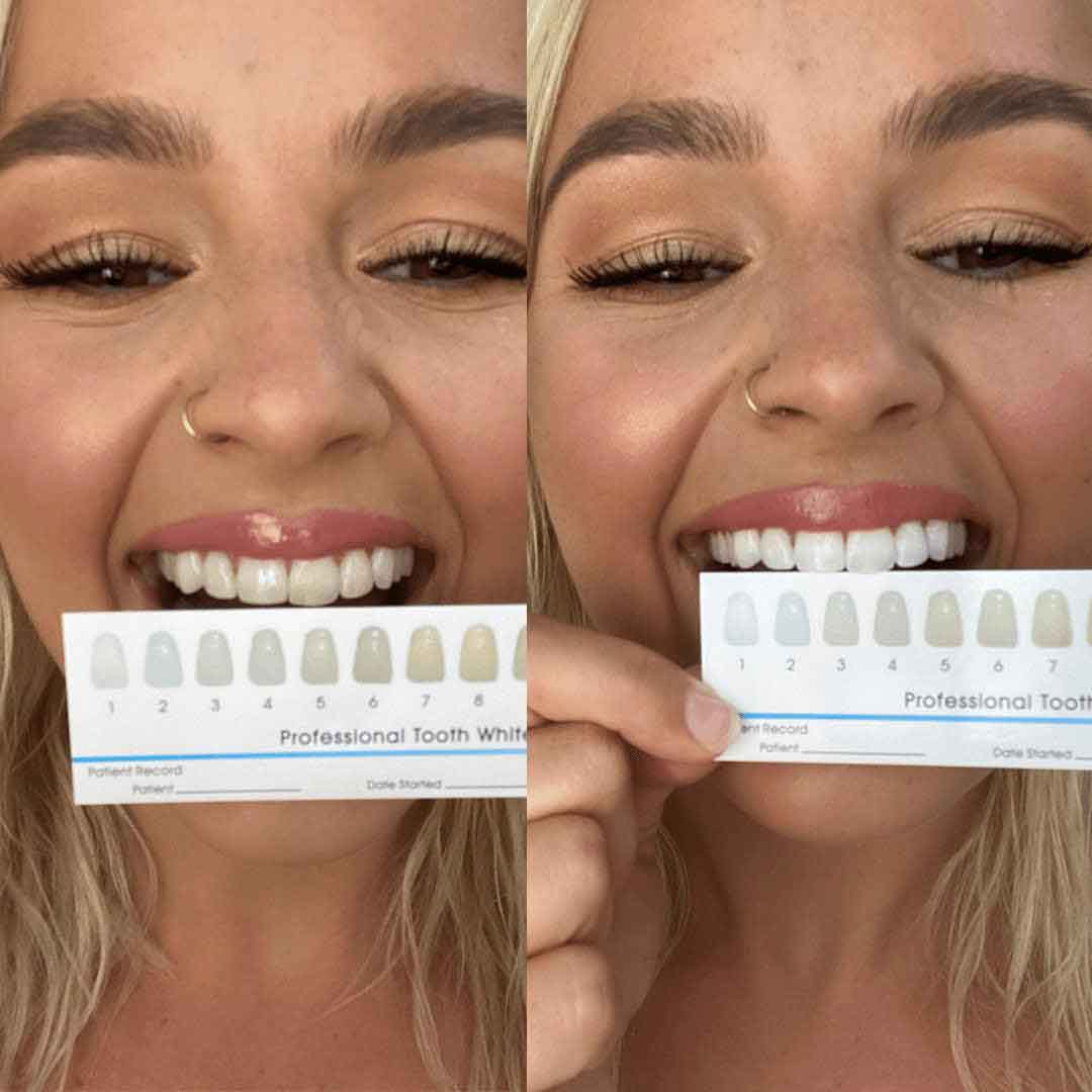 SmilePro Whitening Toothpaste Twin Pack